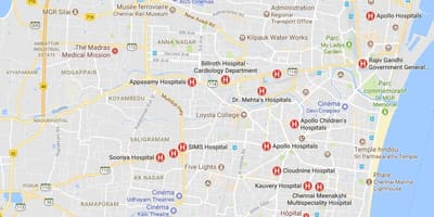 Kart Chennai xəstəxanası 